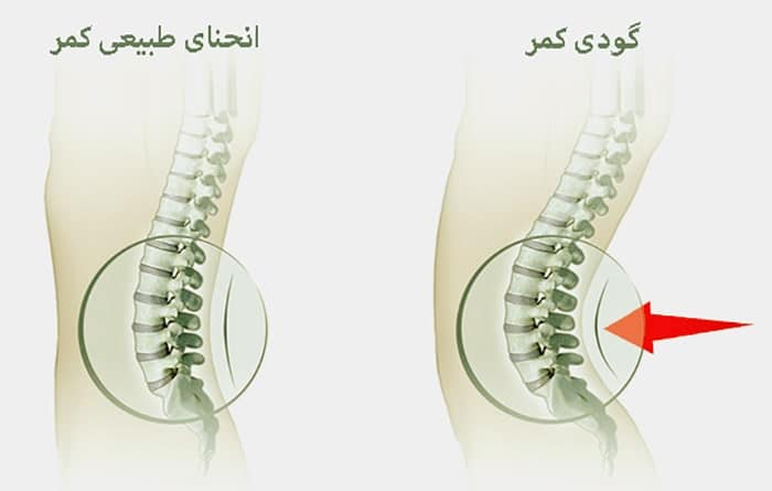 گودی کمر