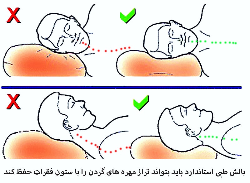 تاثیر بالش طبی در صاف کردن مهره های گردن