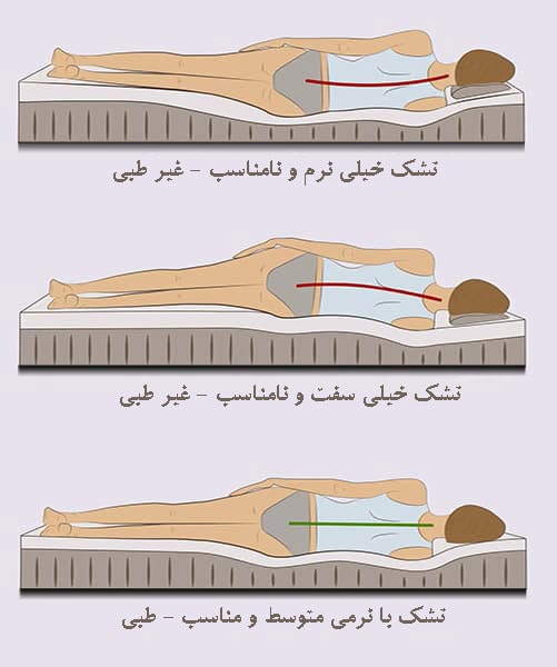 پشتیبانی تشک طبی در حالت نرم، سفت و مناسب