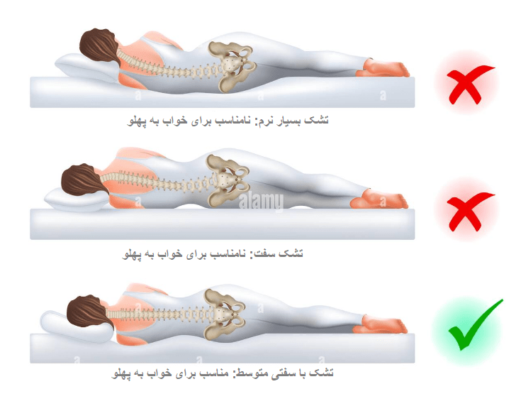 سه تشک نرم، سفت و با سفتی متوسط در خواب به پهلو